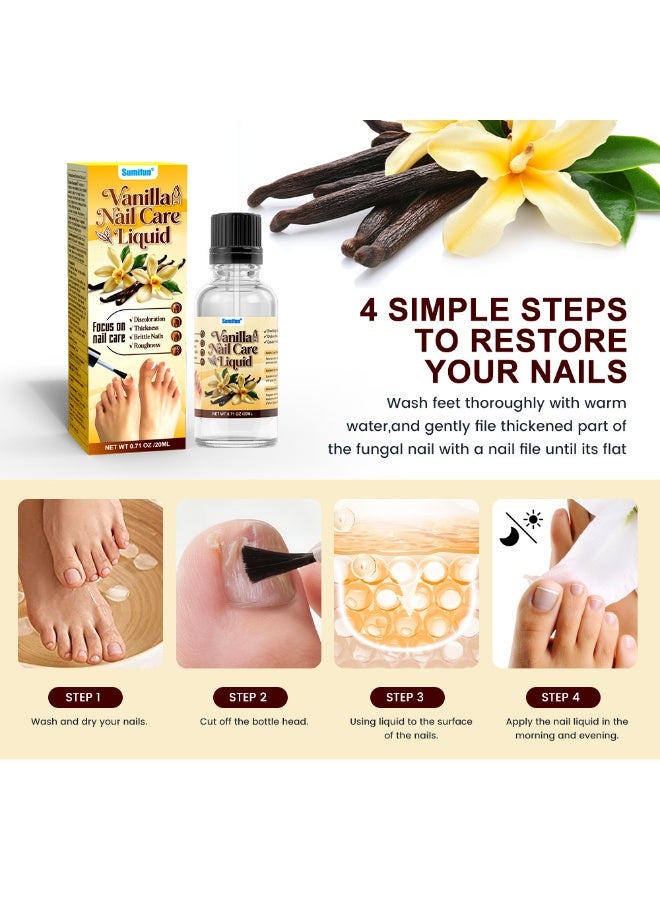 سوميفون محلول سومي فن للعناية بالأظافر: ٢٠ مل - يُصلح ويُقوي الأظافر، ويُعالج الأظافر الهشة، ويُغذيها للحصول على سطح أظافر صحي ولامع. - Image 3